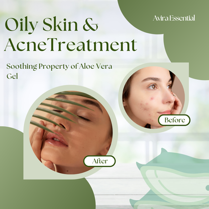 Aloe Vera Gel with Jojoba Oil